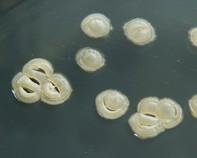 streptomyces colonies